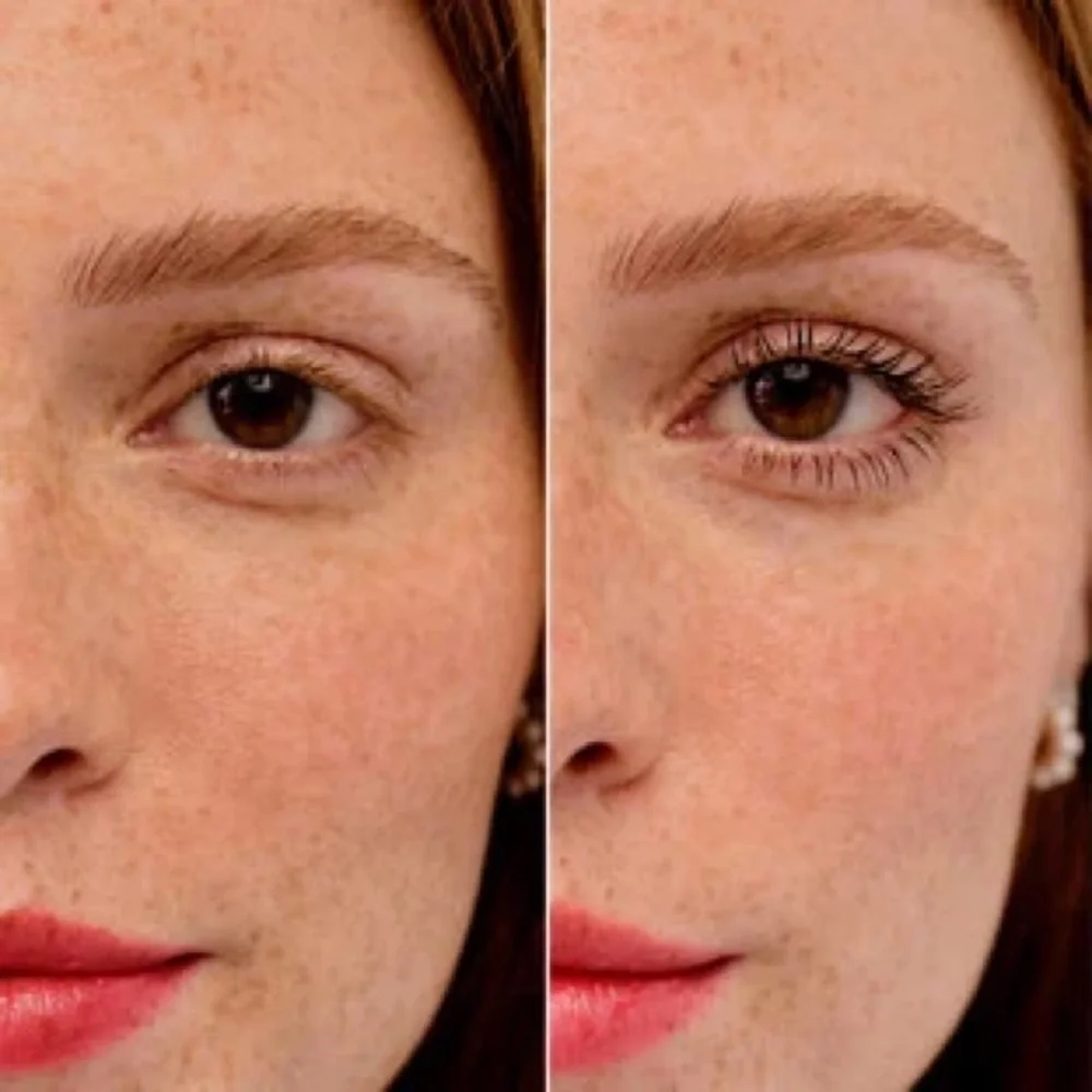 Benefit see above