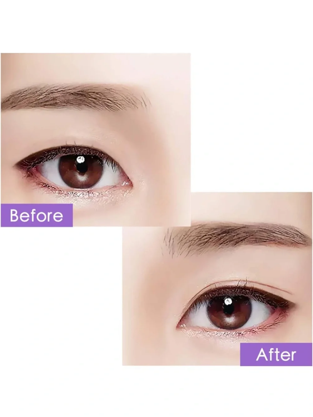 N/A reusable eyelid